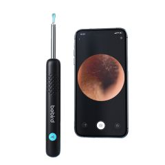 Bebird - R1+ 挖耳監控棒 DCBBR1